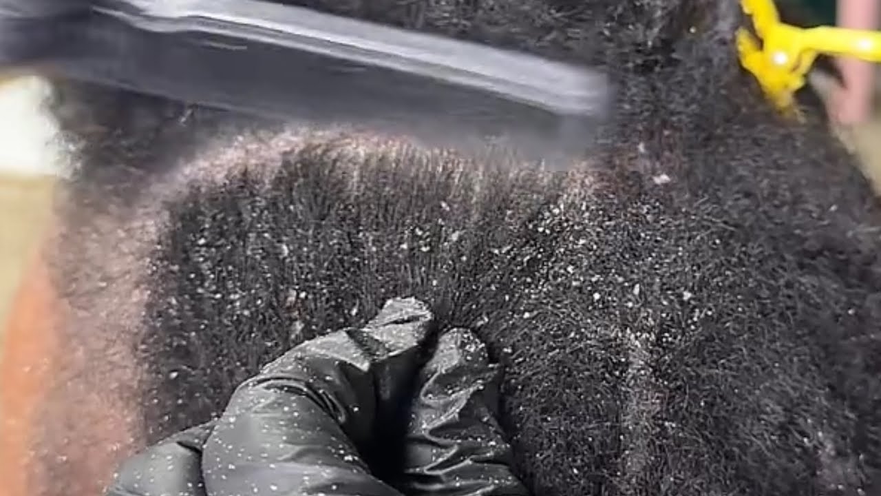 NEW: ASMR- dandruff scratch on locs