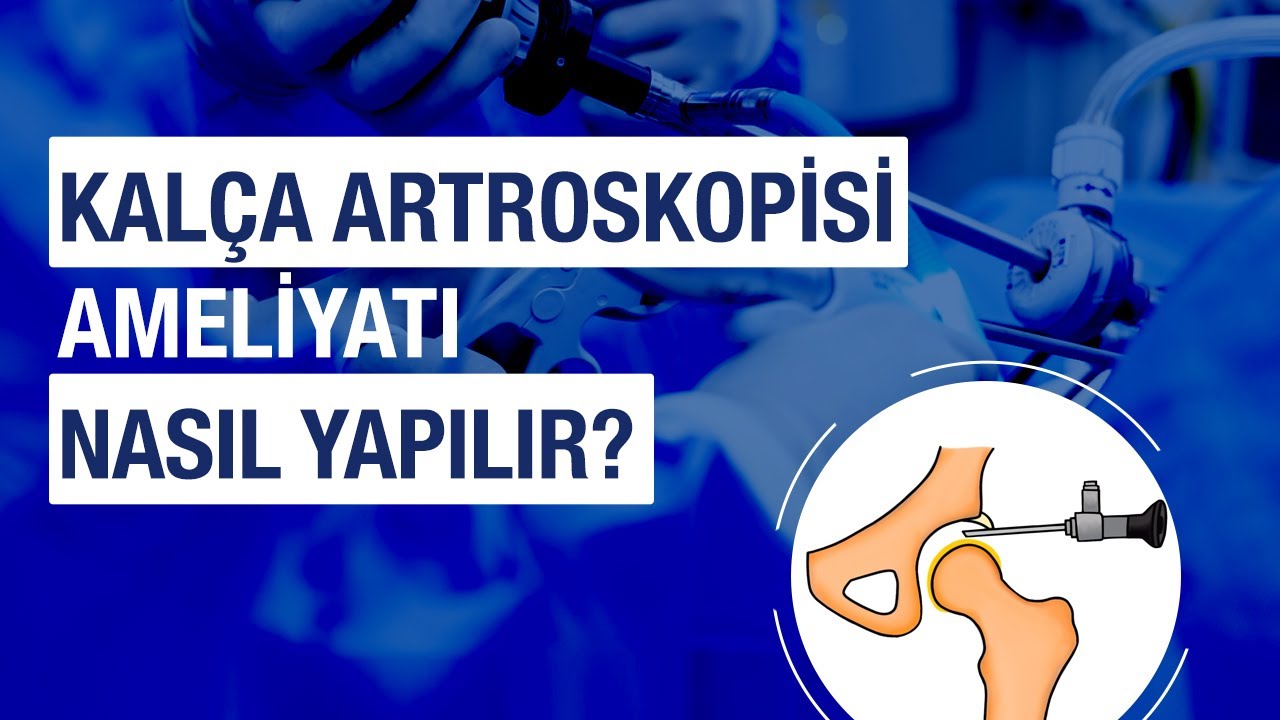 Kalça Artroskopisi Hangi Durumlarda Yapılır? Kalça Artroskopisi Ameliyatı Nasıl Yapılır?