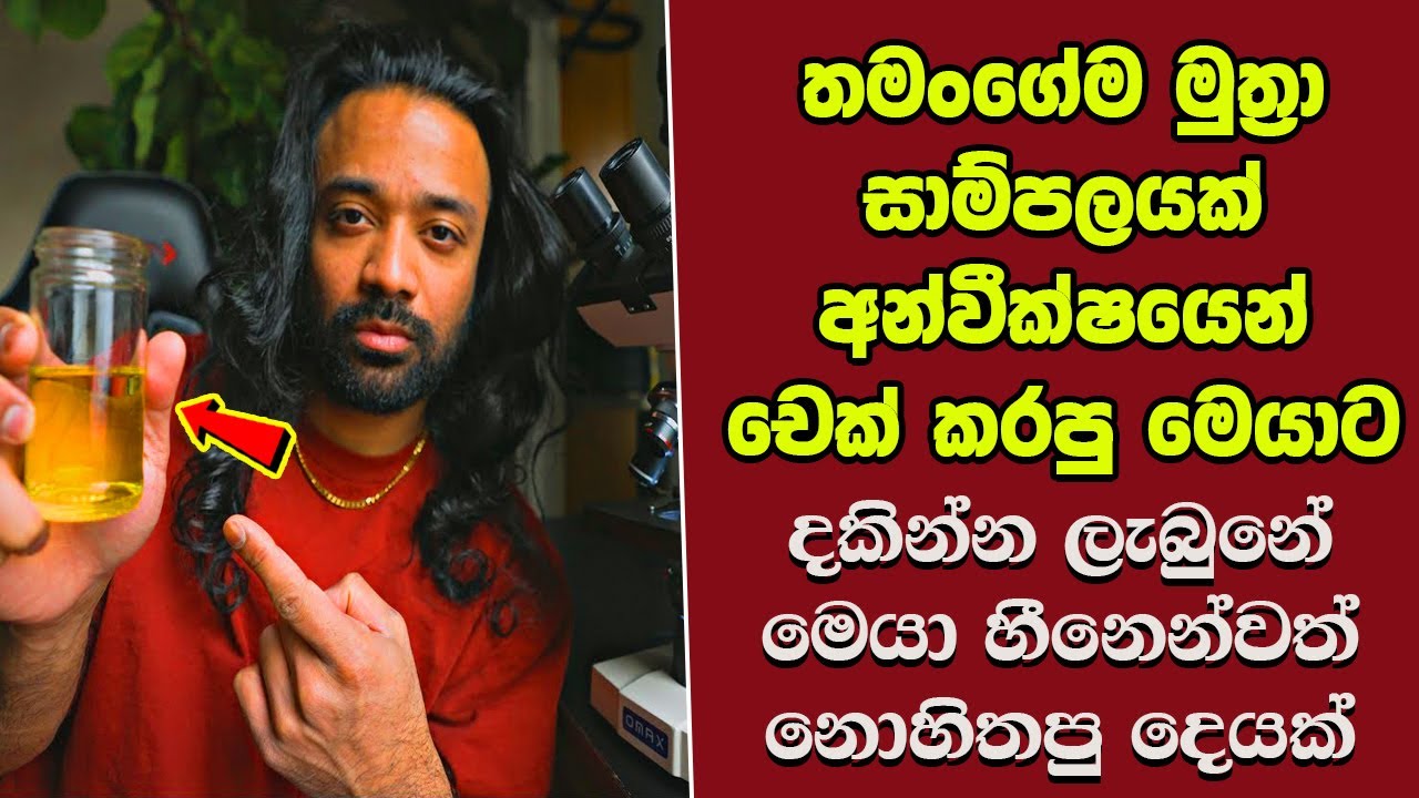 මේවා නොදකින දෑස කුමටද ? EP:71