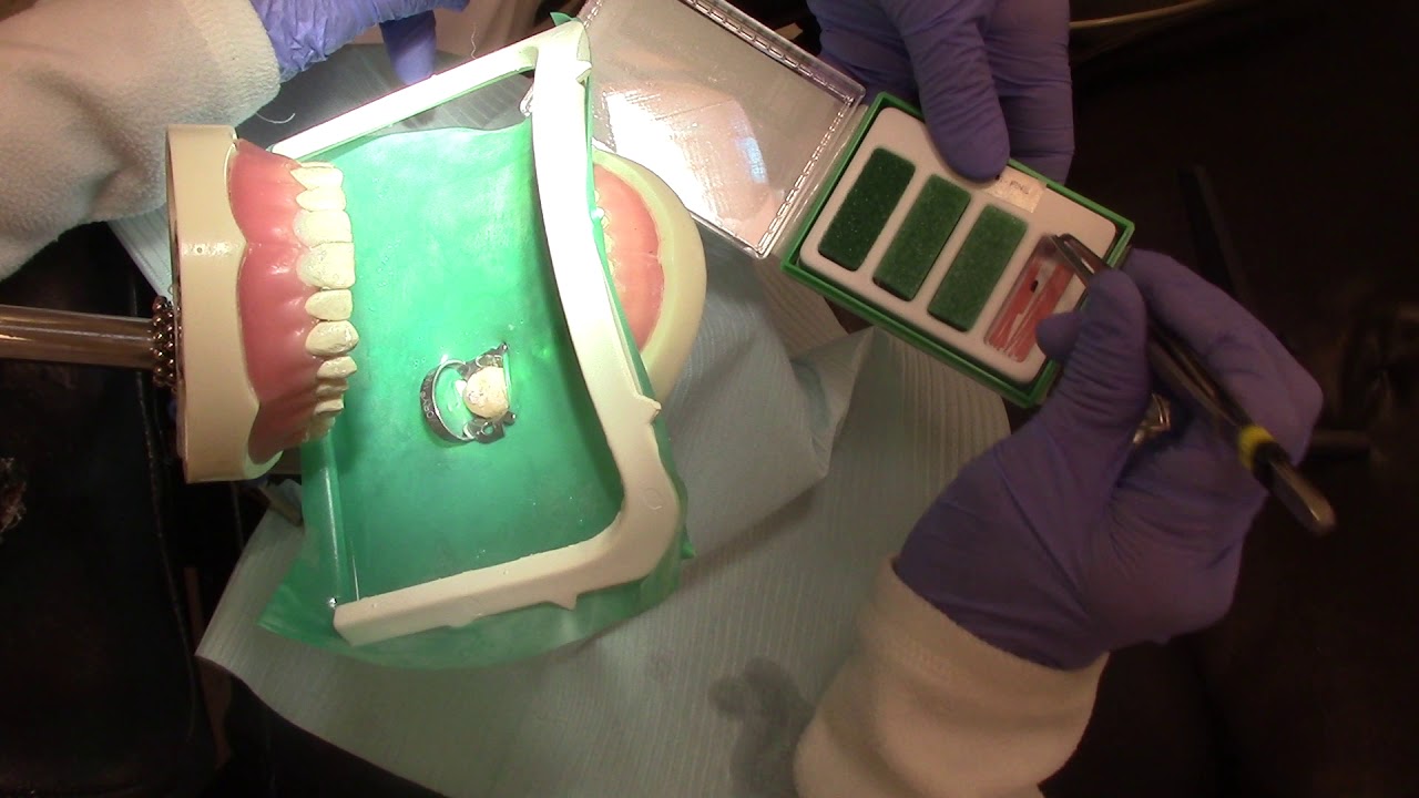Root Canal Procedure