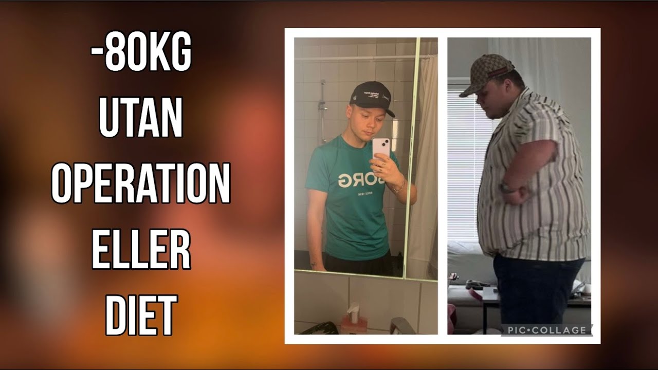 HUR JAG GICK NER 80KG UTAN OPERATION - THEOS VIKTRESA