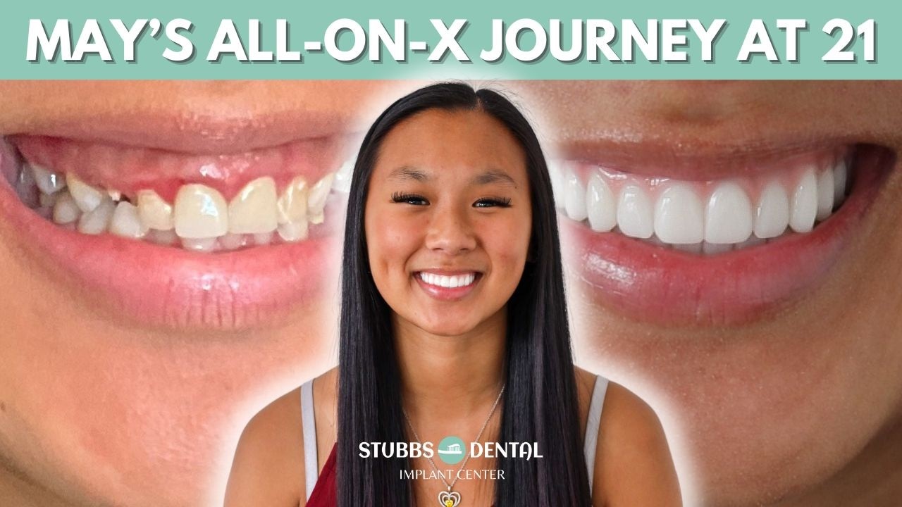 May's Smile Transformation Journey: Getting the All-on-X at 21 Years Old