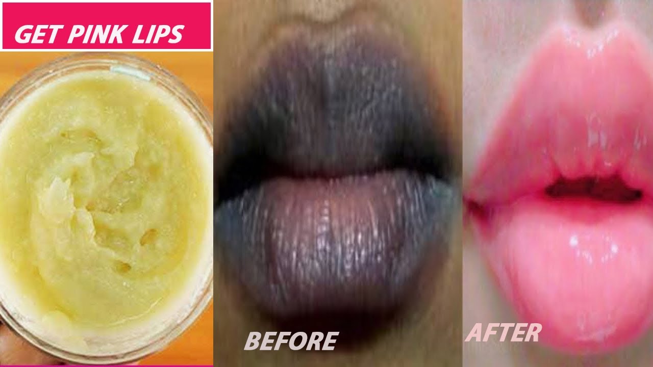 Easy Ways To Make Your Lips Pink NATURALLY In 1 Weeks (Easy And 100% Works)