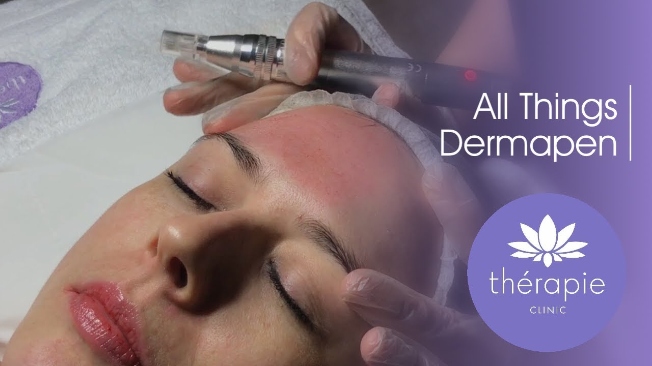 All Things Dermapen | Therapie Clinic