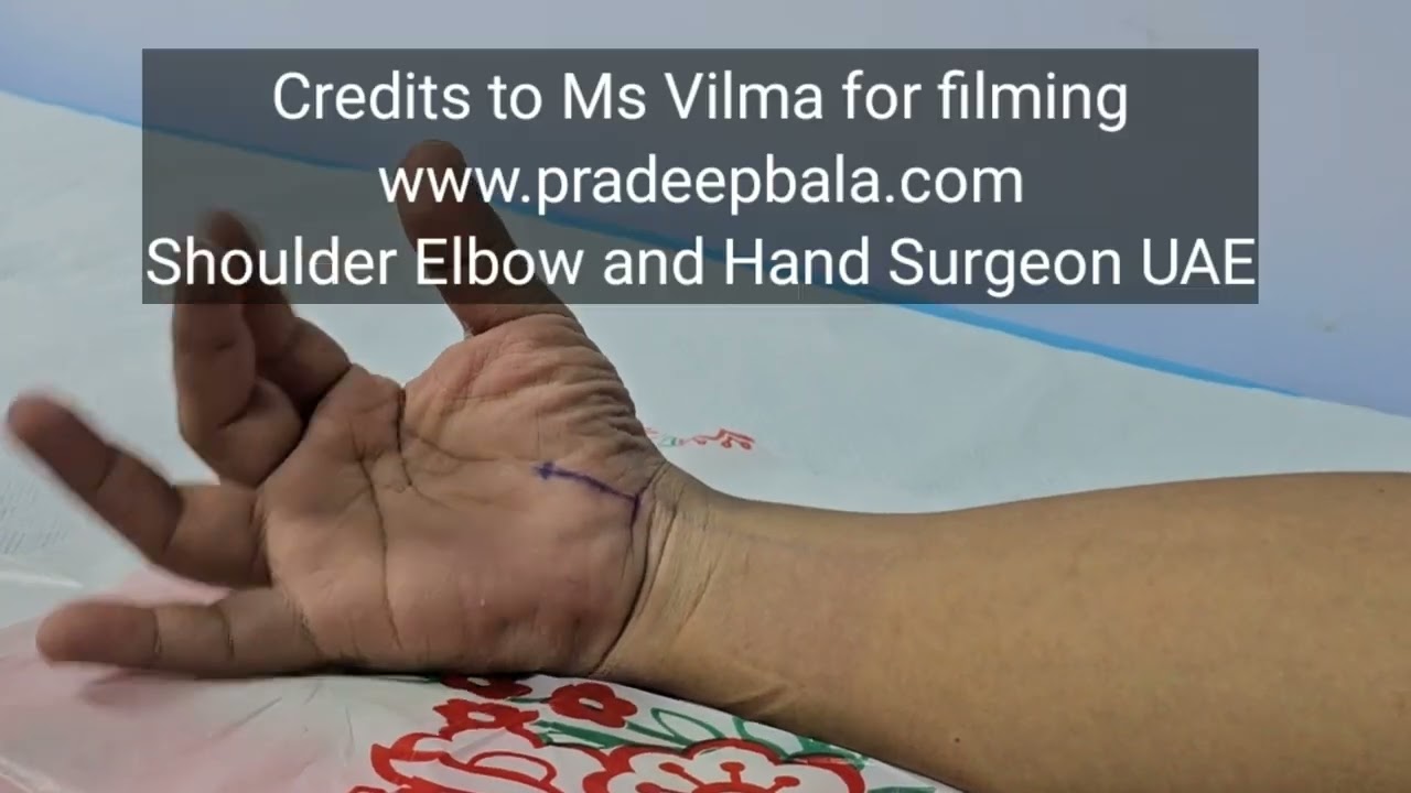 Carpal Tunnel Steroid Injection | Dr Pradeep Bala