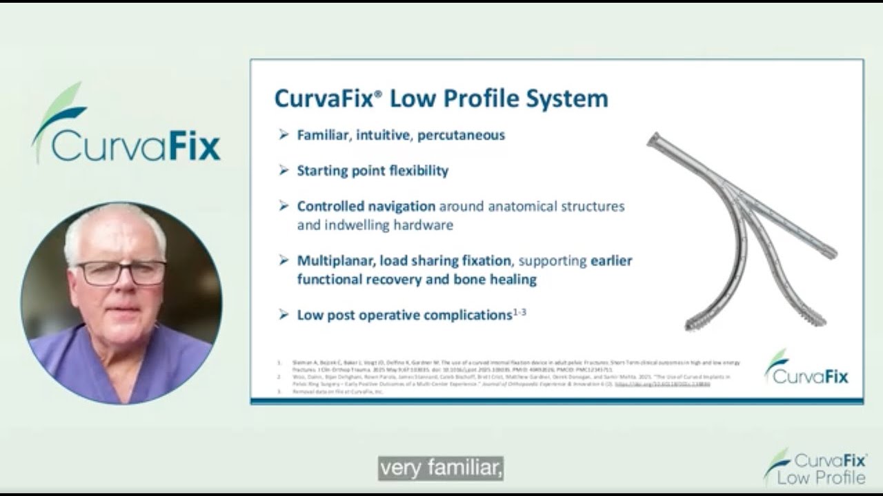 CurvaFix Low Profile Surgeon Testimonial