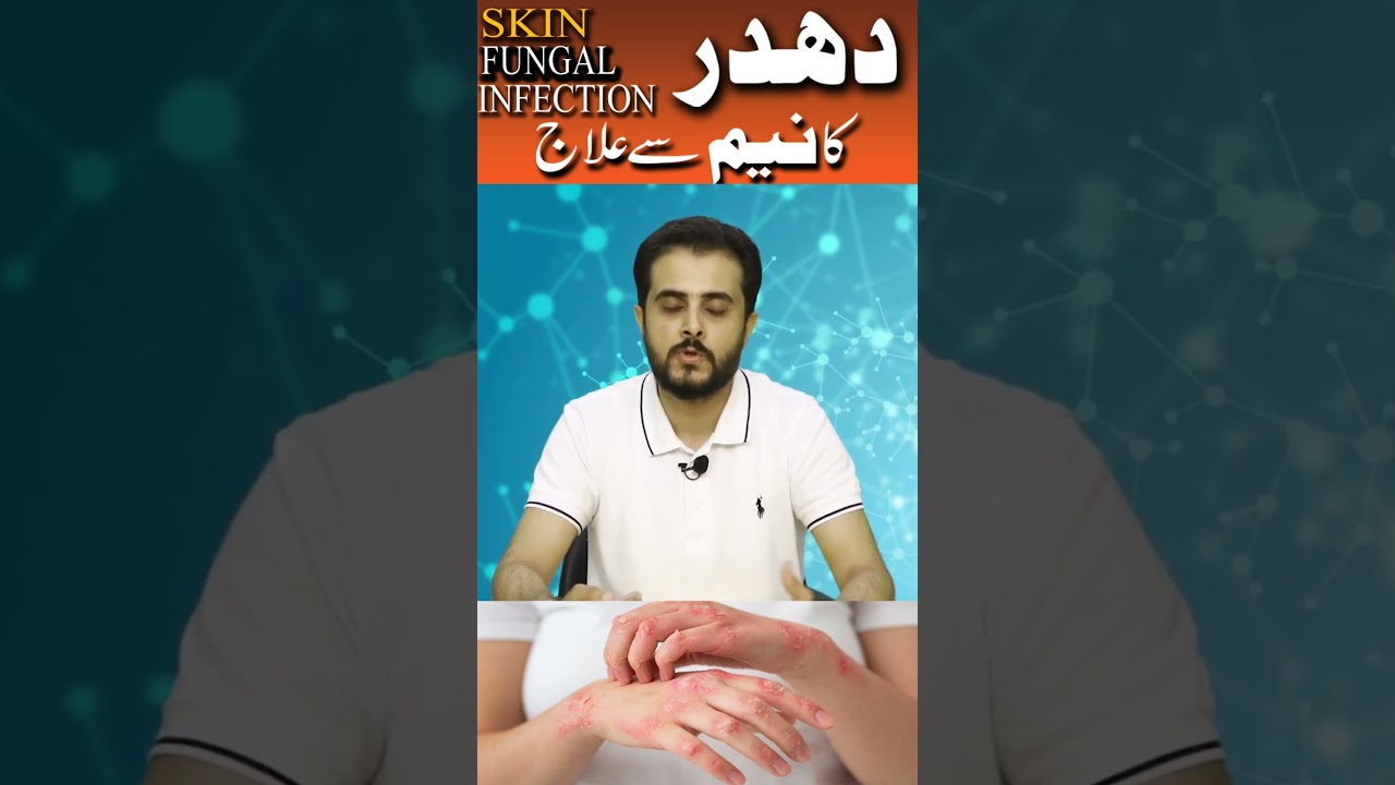 Neem sy Fungus ka ilaj #homeremedies #fungustreatment #fungalinfection