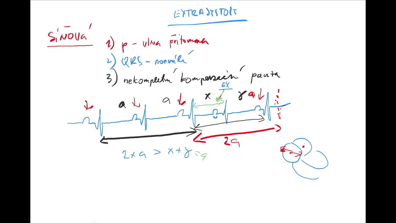EKG 4 by Coiled CZECH (extrasystoly síňové a komorové, komorová tachykardie, fibrilace komor)