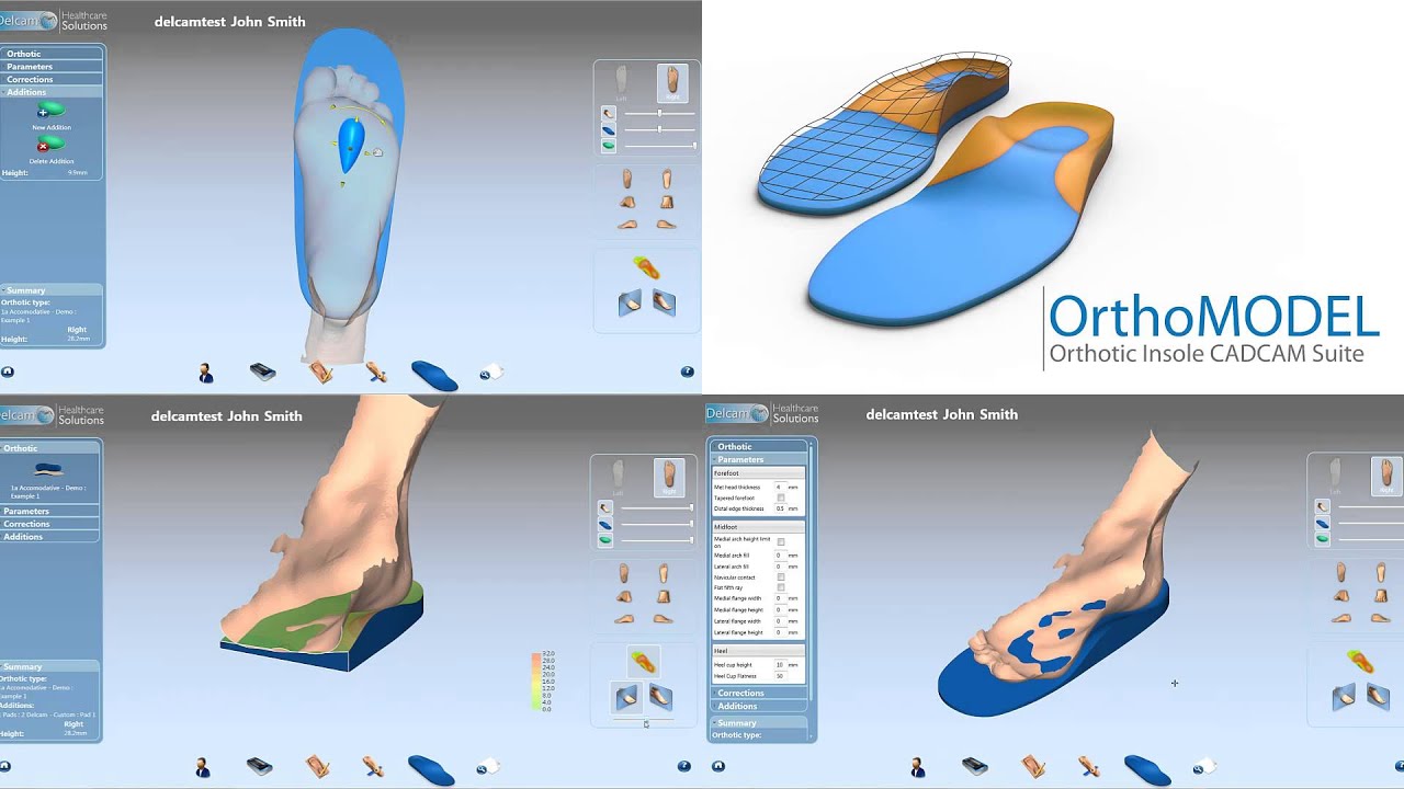 Delcam Orthotic Insoles CADCAM and scanning solution