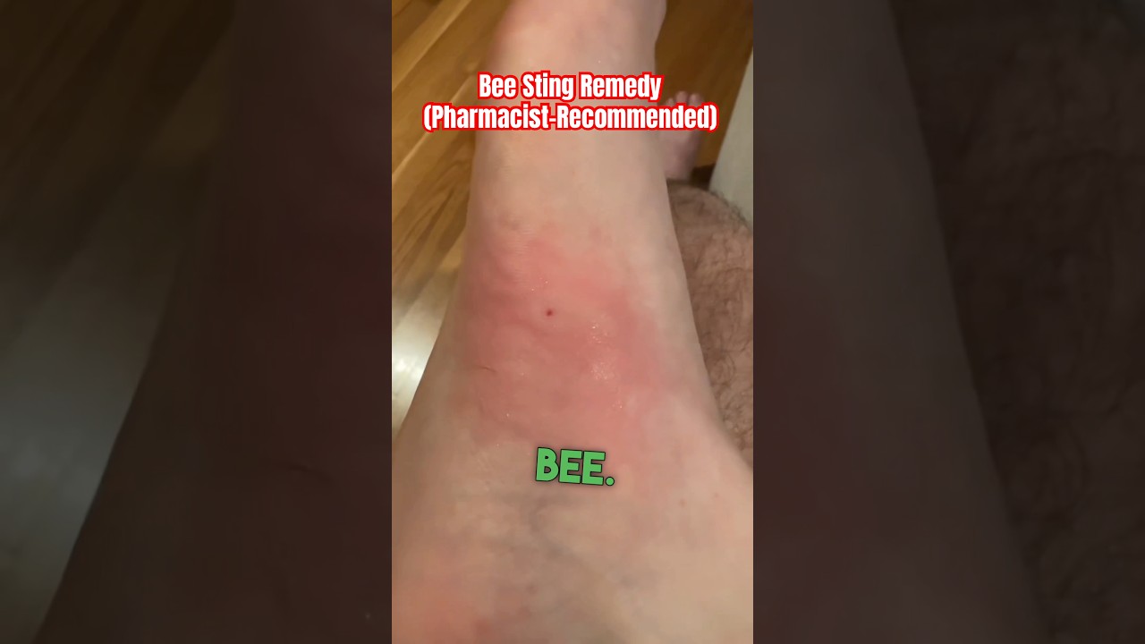 Укусы пчел 101 #фармацевт #укус пчел #пчелы #пчела #аптека #лекарство #шорты