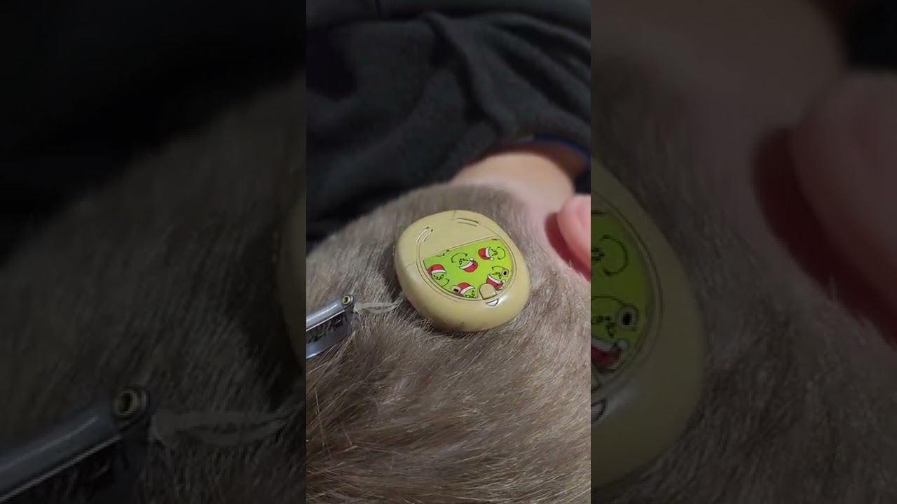 Connecting the Roger Touchscreen to a Cochlear Kanso