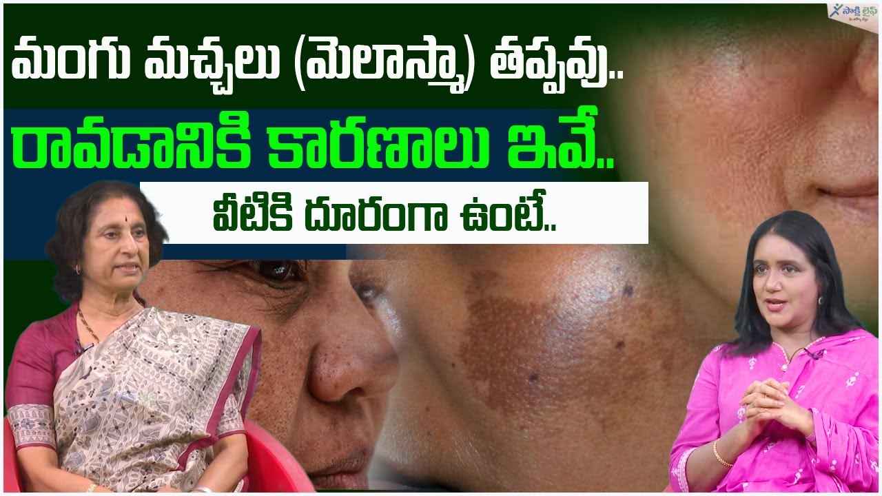 Melasma: Treatment, Causes & Prevention | Dr. Chandravathi | Sakshi Life