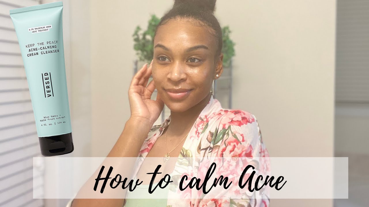 HOW TO CALM ACNE | VERSED ACNE CLAMING CREAM CLEANSER
