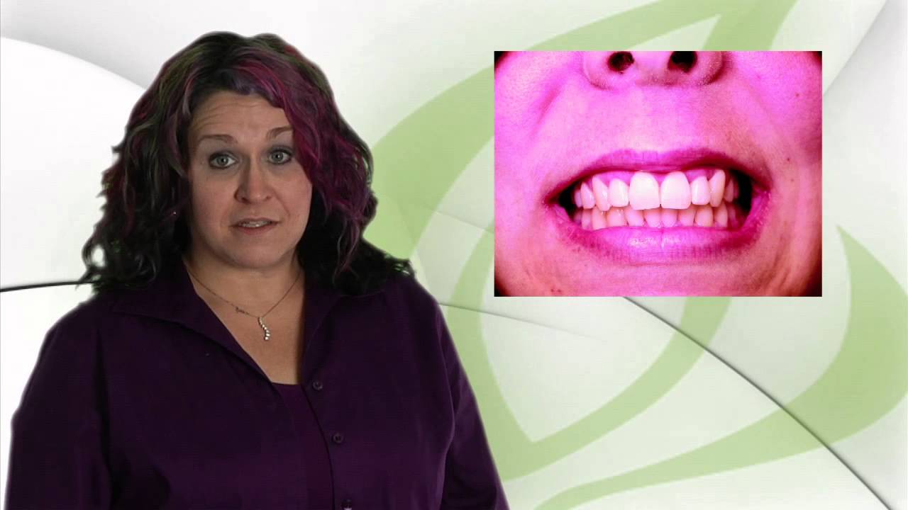 Will High Speed braces damage my teeth?  Dr Rochon