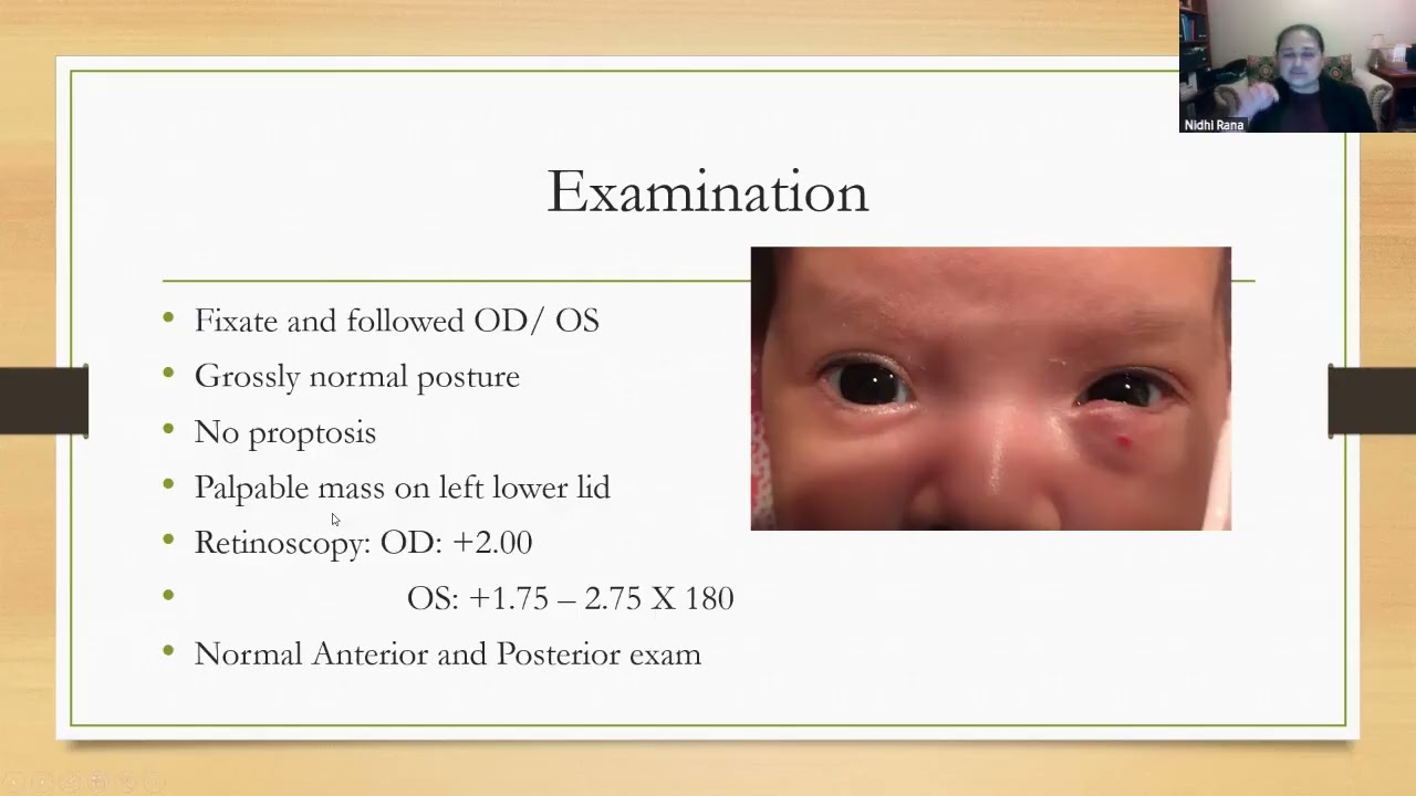 Tiny Eyes, Bigger Challenges: Managing Pediatric Ocular Disease