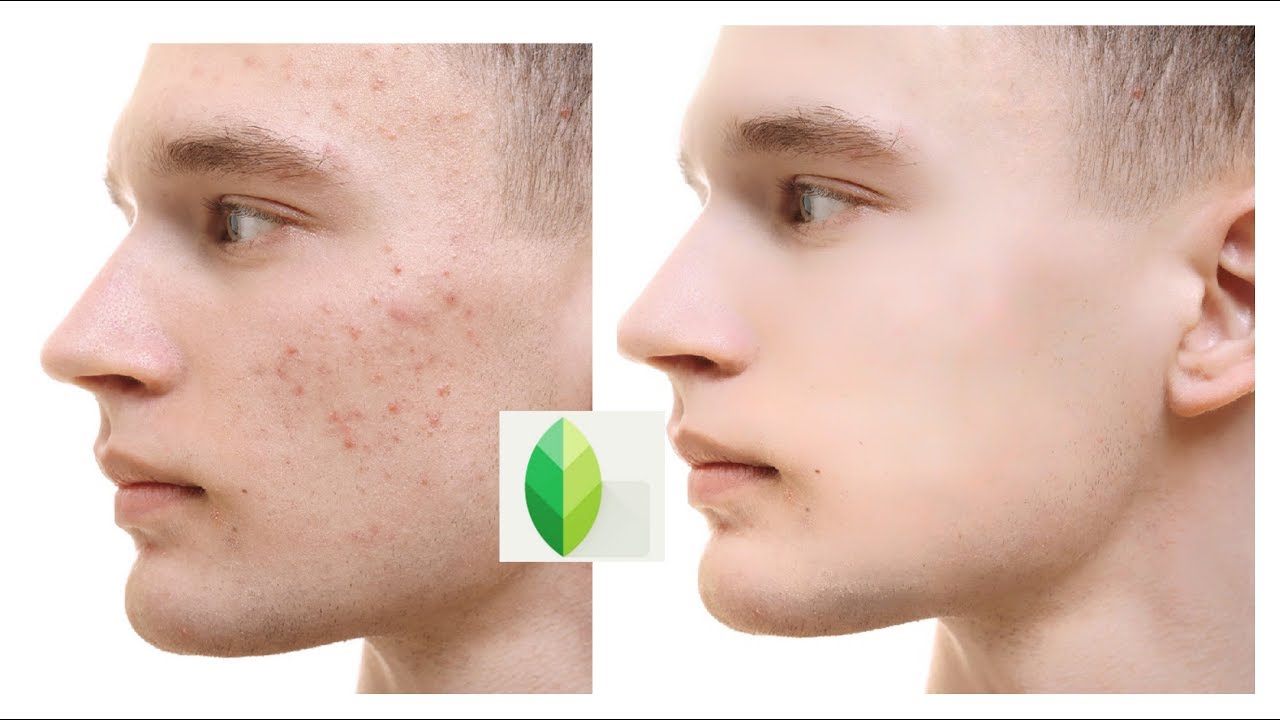 How to remove pimples in face , get smooth glow face in Snapseed Best edting