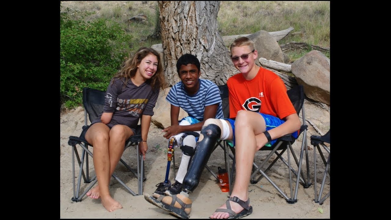 Summer Un-Limb-ited camp 2017
