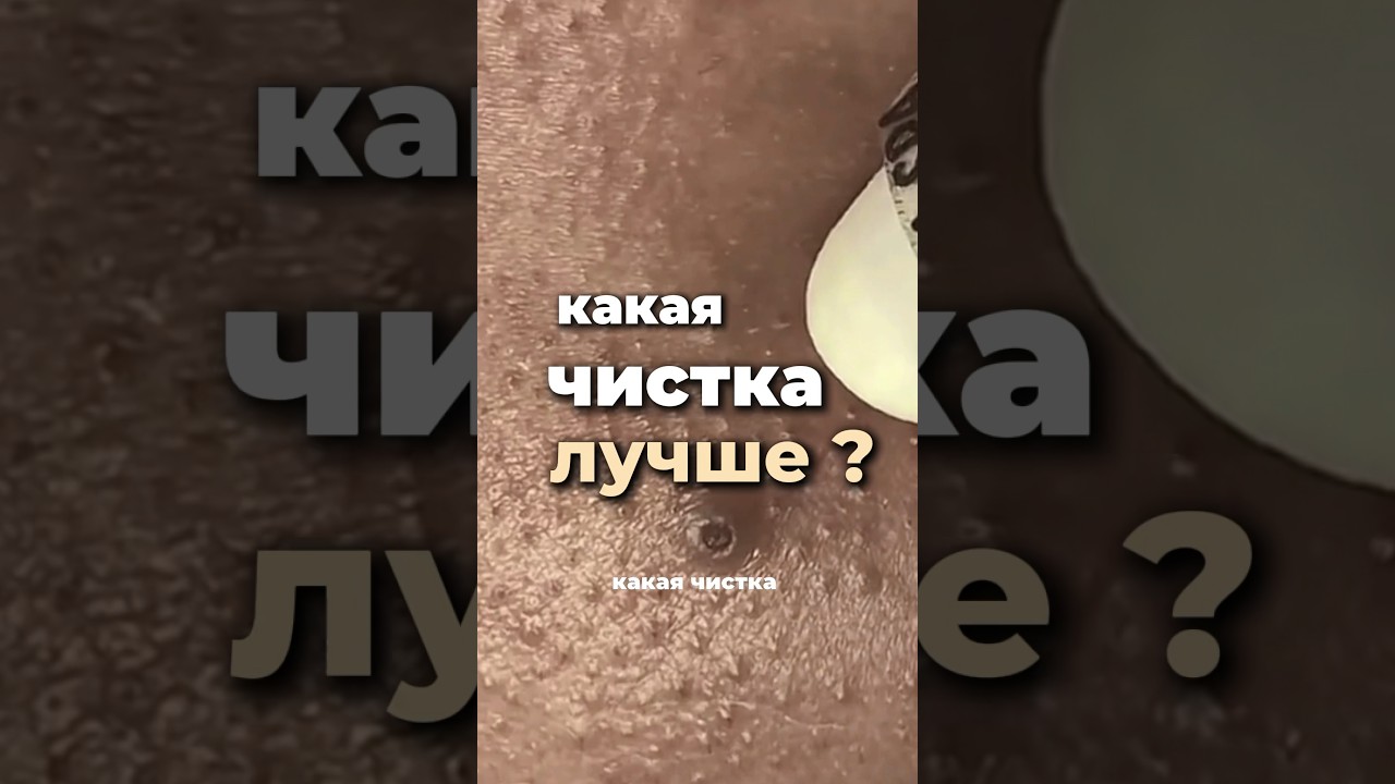 Какая чистка кожи лучше ? Вакуум ,ультразвук , механическая ,гайд по уходу в лс#кожа #уходзакожей