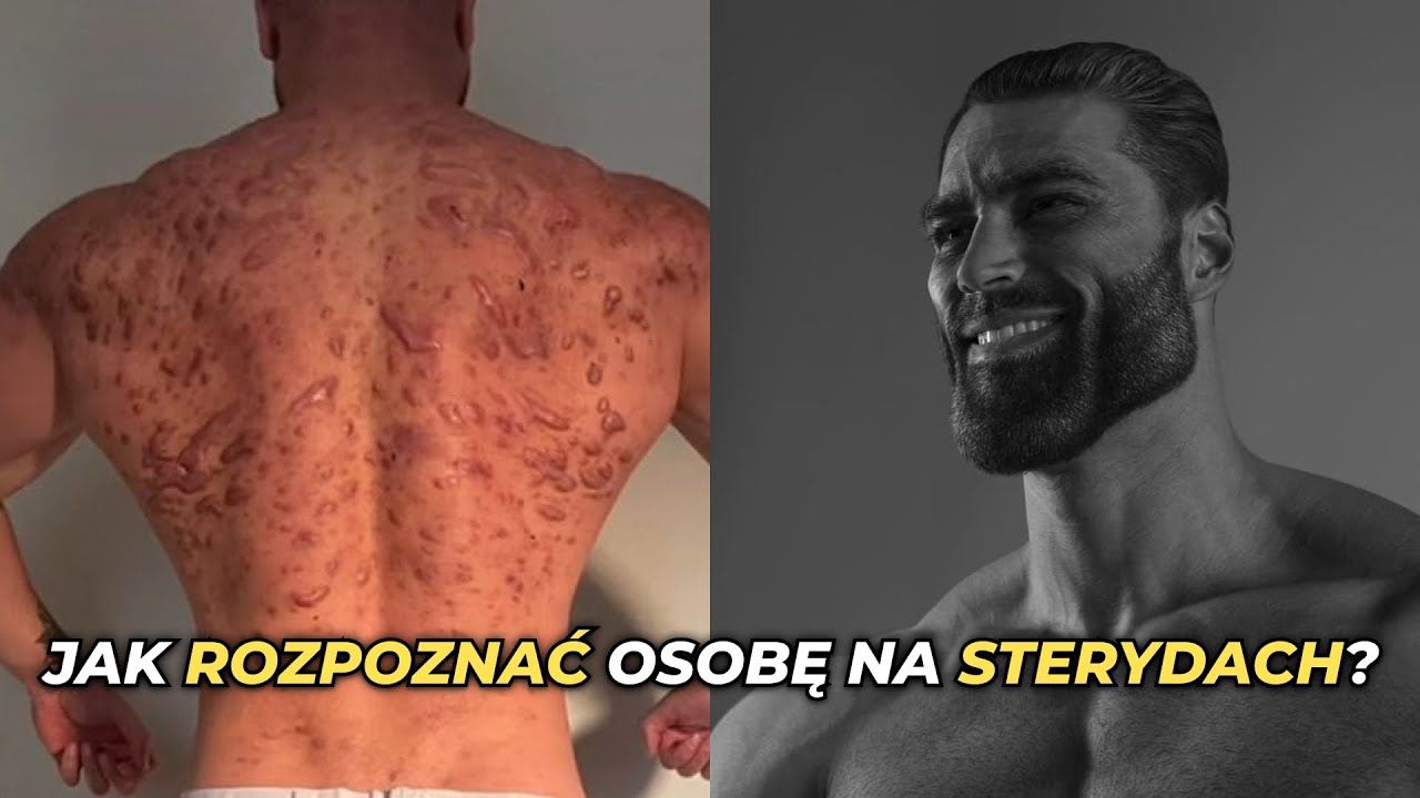 JAK SPRAWDZIĆ czy KTOŚ JEST NA CYKLU? | STERYDY - JAK JE WYKRYĆ? | EFEKTY UBOCZNE STERYDÓW