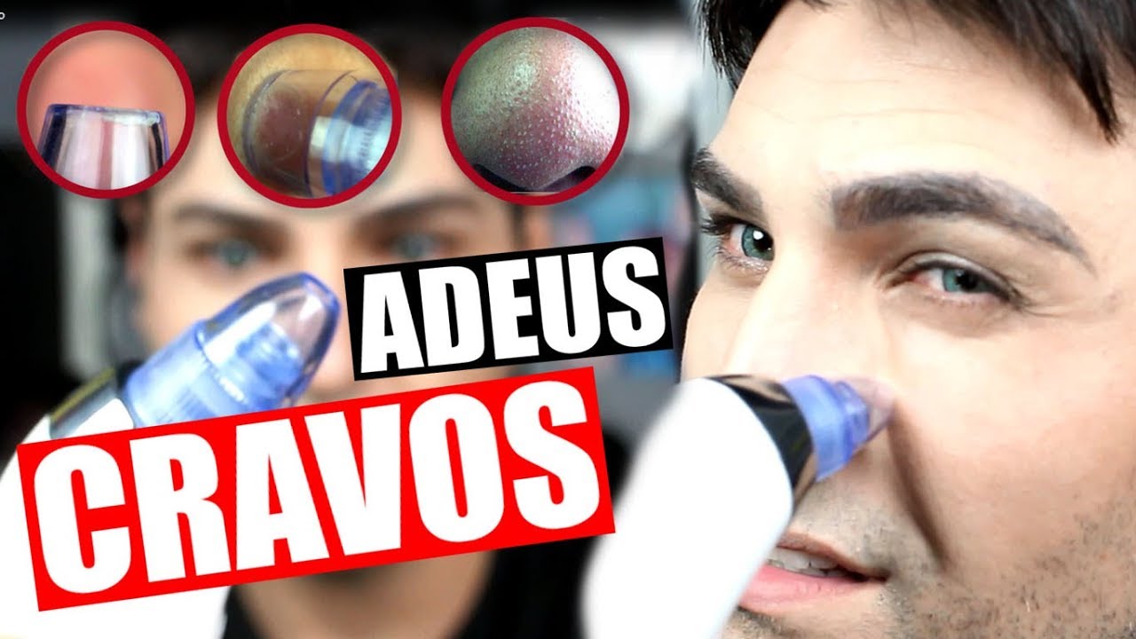 MAQUINA PARA REMOVER CRAVOS EM UM MINUTO| 😱 MILAGROSO 👏🏻