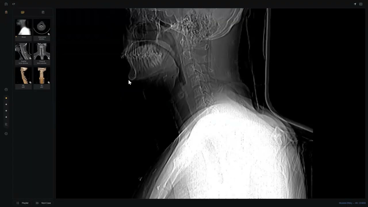Trauma Viva/oral cases 1