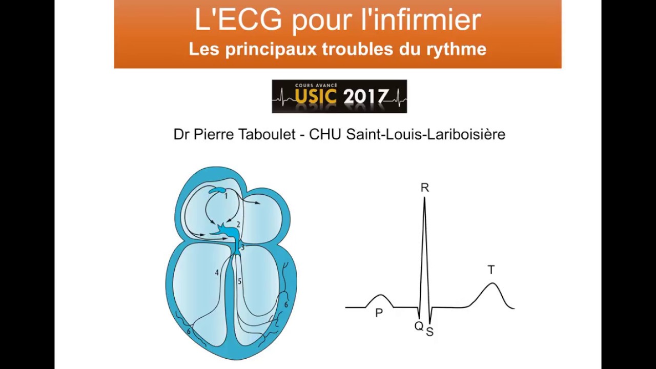 6c. Les principaux troubles du rythme ECG à l'usage de l'infirmier. Dr Taboulet