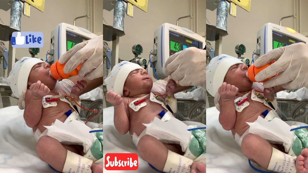 Cute Baby in NICU Feeding for the First Time | Nicu care | Nurse love#nicubaby #baby #hospital 