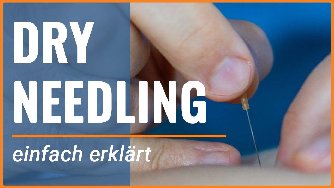 Dry Needling Behandlung von schmerzhaften Triggerpunkten
