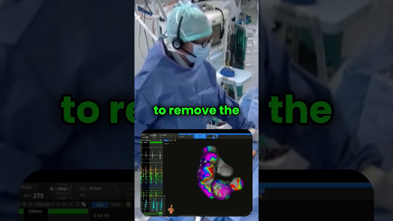 RHYTHMIA Mapping with INTELLAMAP ORION High-Resolution Mapping Catheter