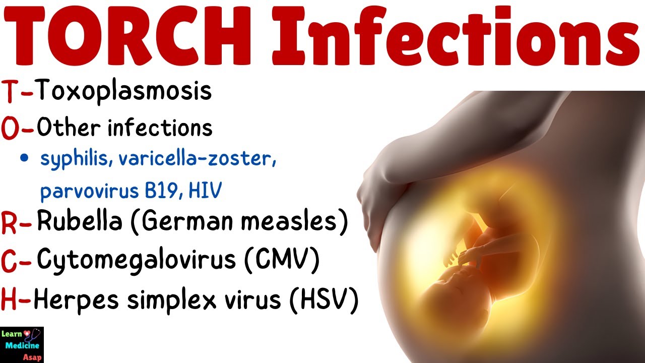 TORCH Infections: Causes, Risks, Symptoms, Diagnosis & Treatment | TORCH Syndrome - Obstetrics