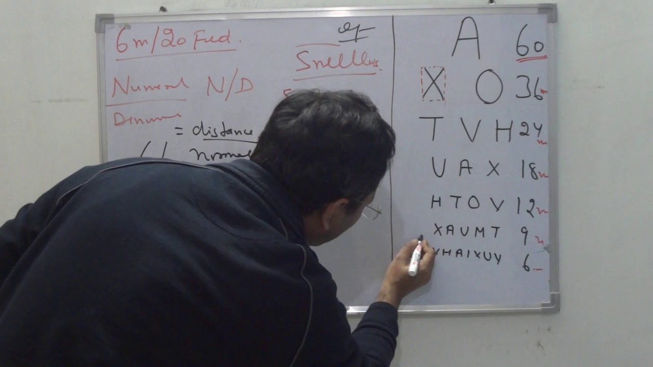 for practical exams- visual acuity testing and trial lenses,box