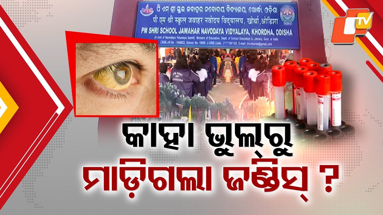 Jaundice Outbreak at Khordha Navodaya School: Who Is Responsible?