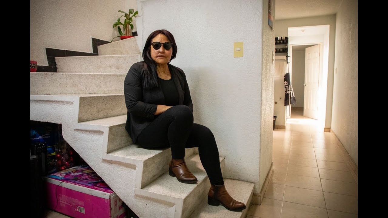 Fundación Carmen Sánchez MX: un año de apoyar a mujeres víctimas de ataques con ácido