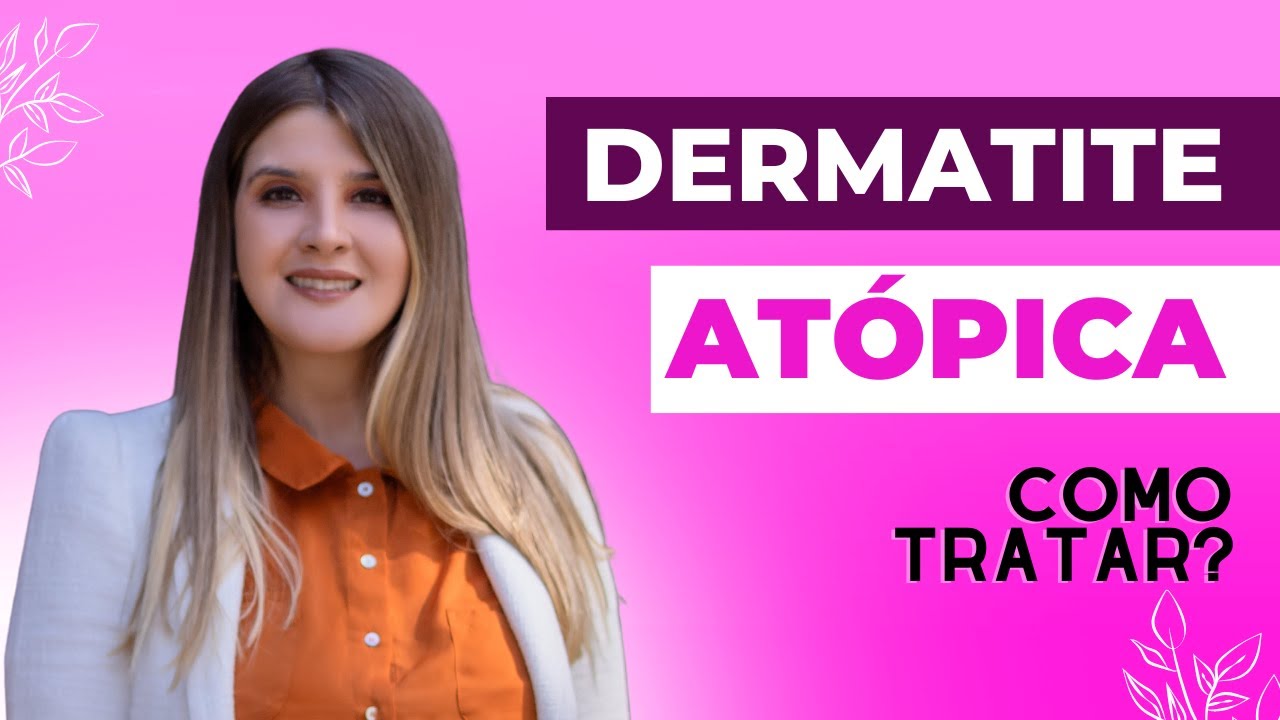 DERMATITE AT&Oacute;PICA - Como tratar e aliviar os sintomas? #dermatite #dermatologia