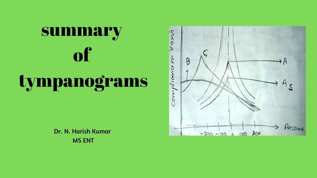 summary of tympanograms | MBBS - ENT