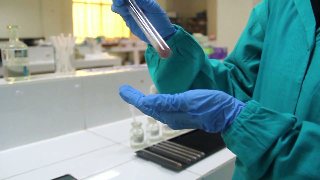 Biokimia Praktikum Karbohidrat - TES MOLISCH