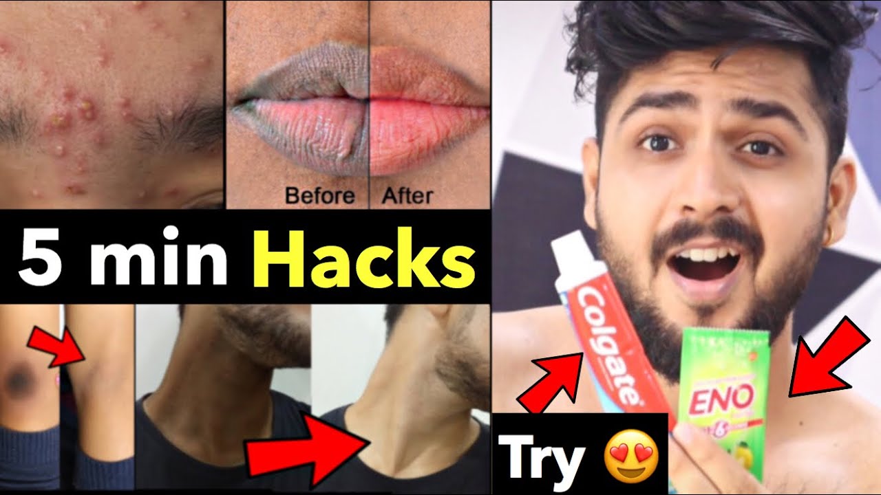 Beauty HACKS every Guy Should Know | Grooming Tips | Black Lips, Pimple Acne, Dark Spots