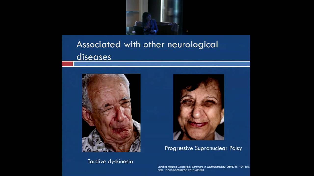 Overview of Blepharospasm and Other Neurological Eye Disorders