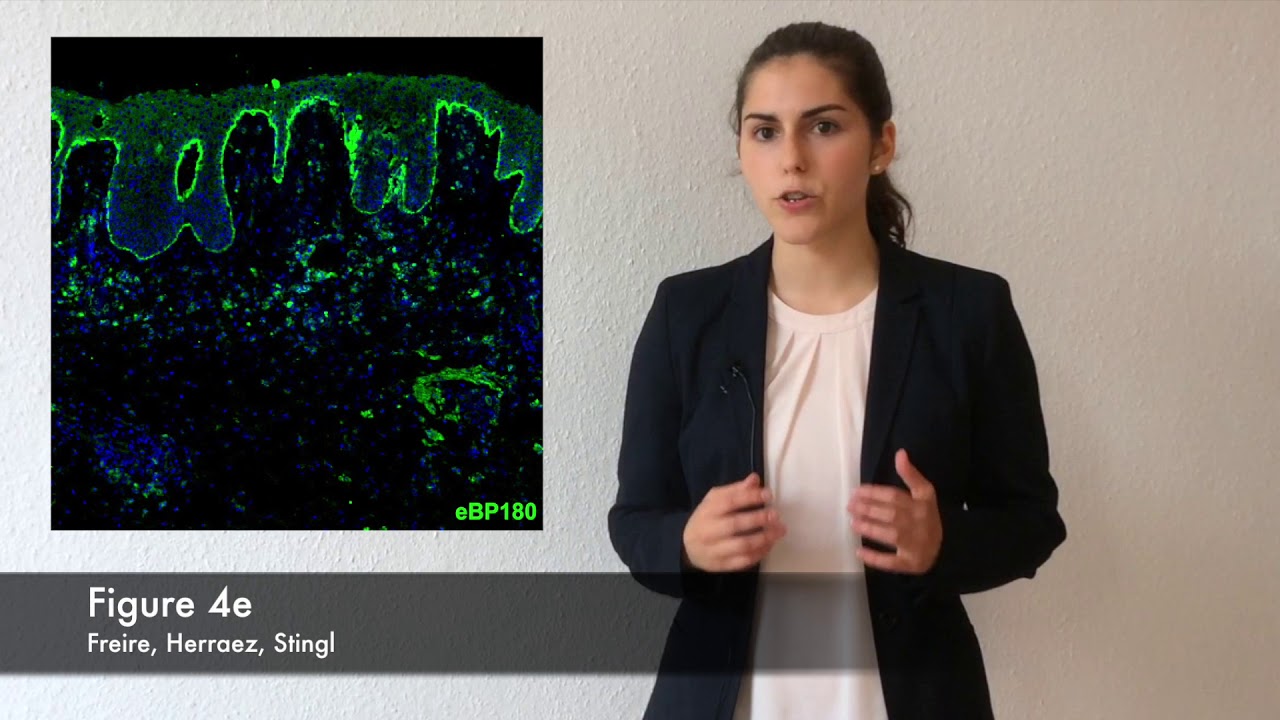 The role of IgE autoantibodies in bullous pemphigoid,  P.C. Freire et al