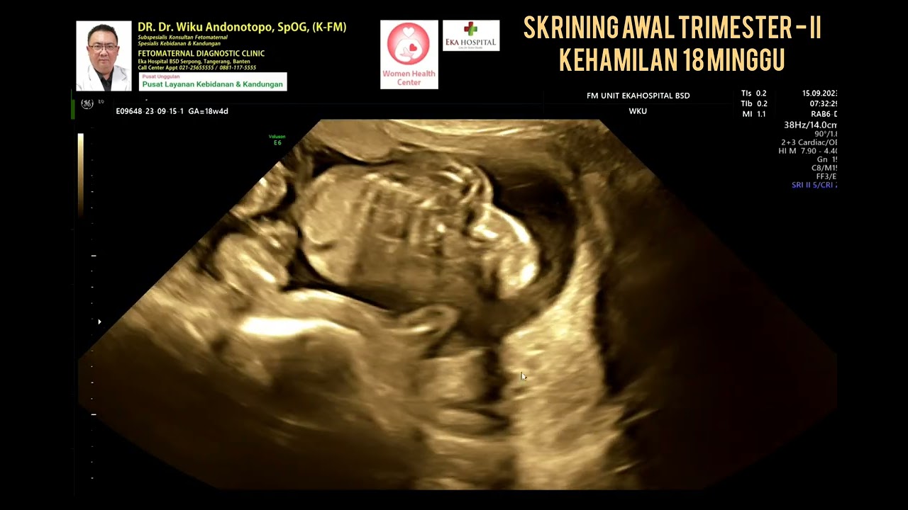 Skrining 18 minggu trimester II