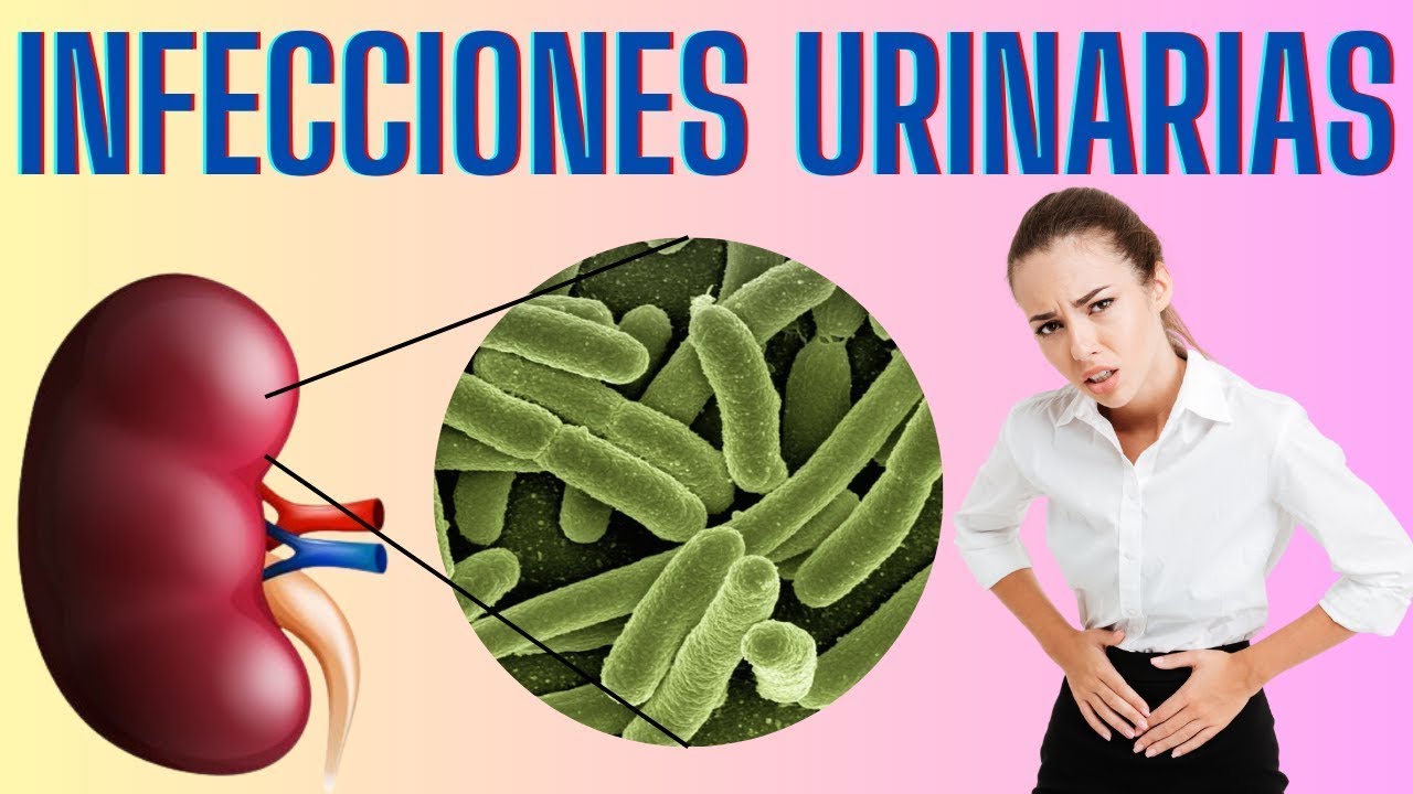 ¿Cómo saber si tengo una infección de vías urinarias?