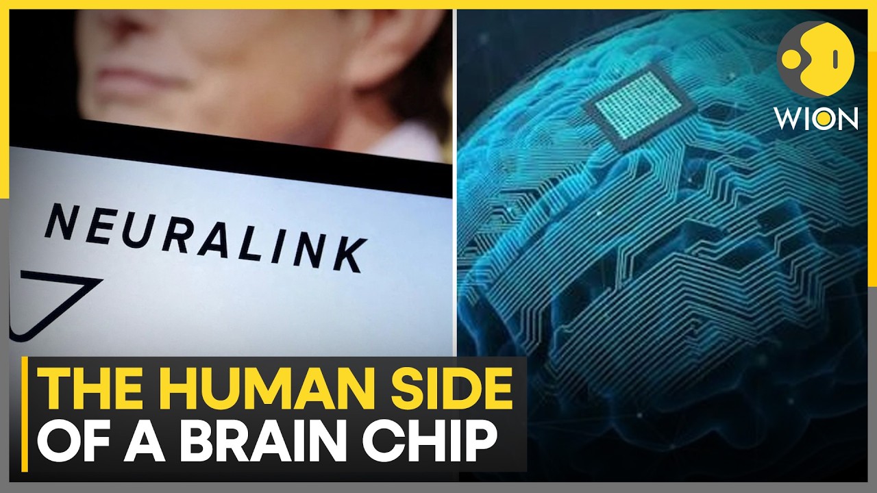 Neuralink Helped One Patient Communicate Using A Synthetic Voice | WION News
