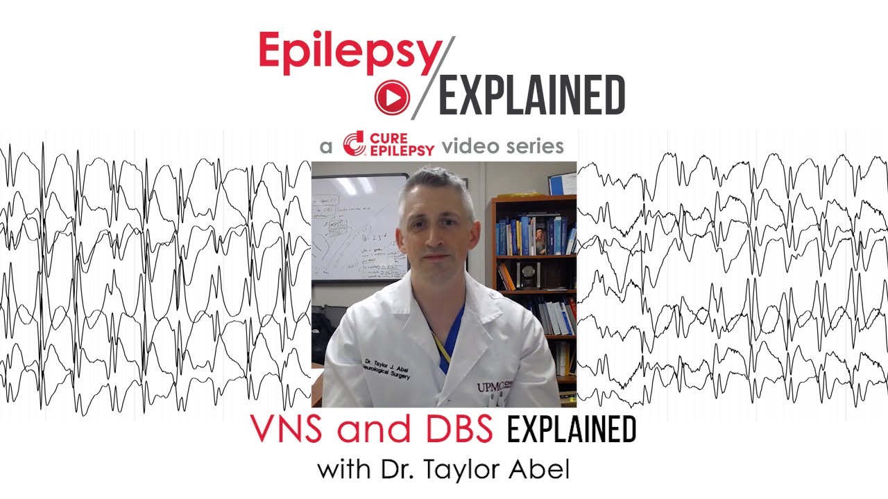 VNS and DBS for Epilepsy: When to Consider Neurostimulation Devices and What  Know