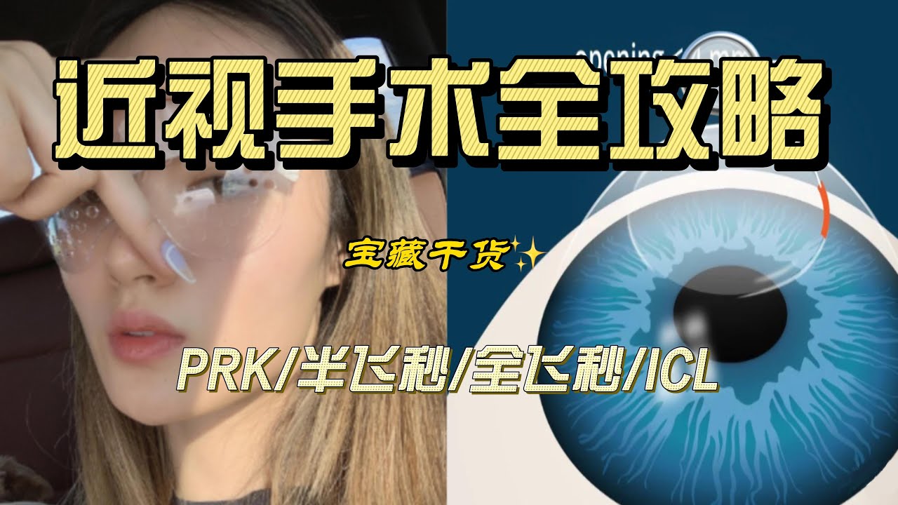干货｜视力恢复手术全攻略｜PRK｜全飞秒｜半飞秒｜ICL｜对比优缺点｜术后一年反弹了吗｜无广优质医院推荐