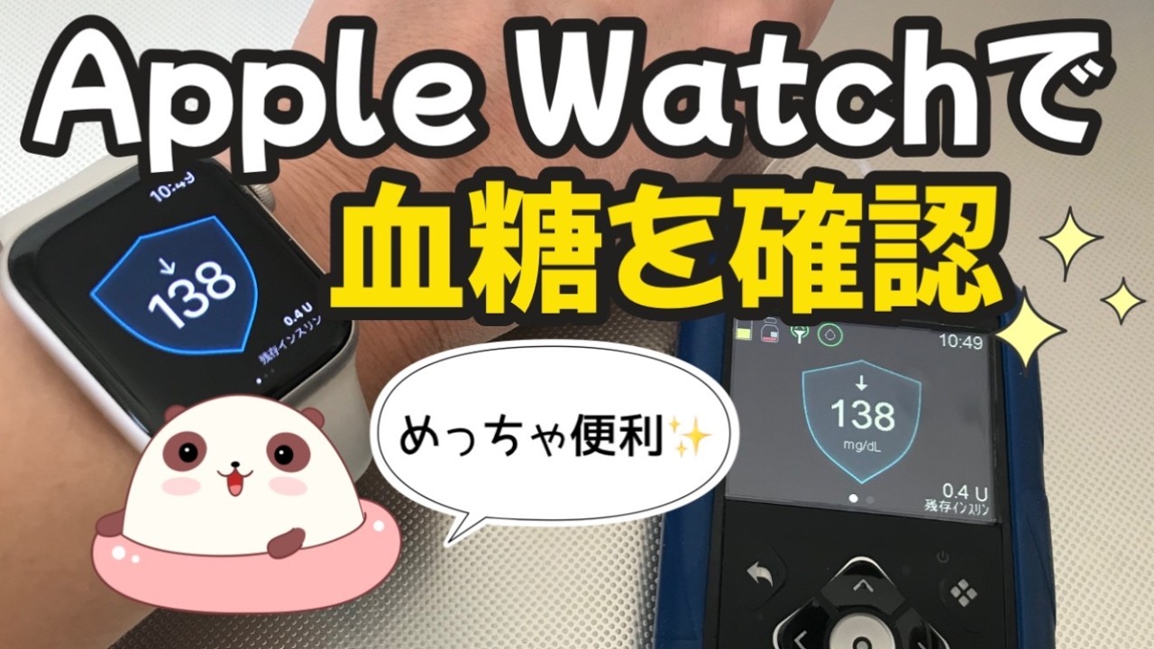 【1型糖尿病】Apple Watchで血糖値が見れる！実際の使用感を私目線で！　CGM　MiniMedミニメド780G