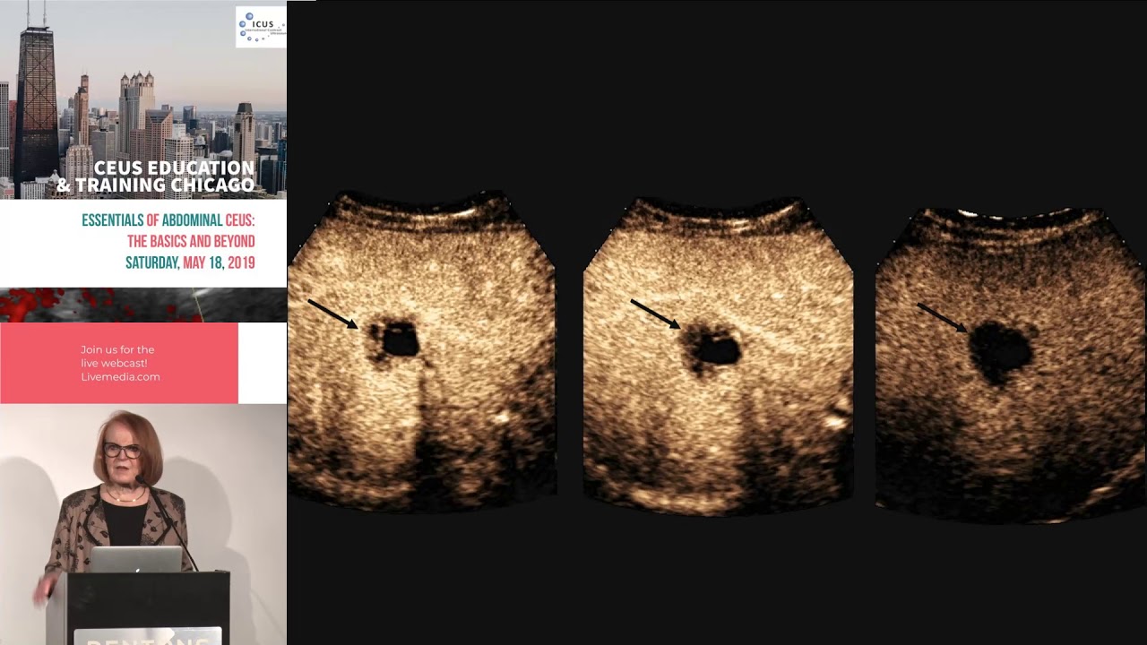Great Cases in an interactive format