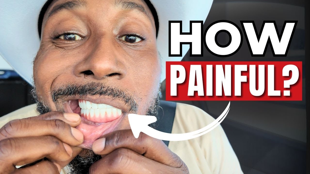 Was Dental Implant Surgery Pain Worth It? My Honest Experience