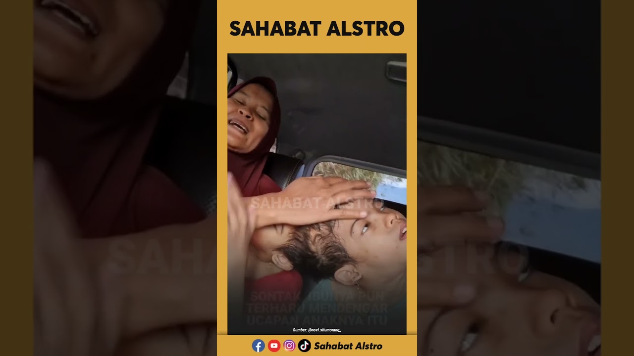 BOCAH KEMBAR INI TAK MAU DIOPERASI DAN DIPISAHKAN, Takut Kakaknya Tiada