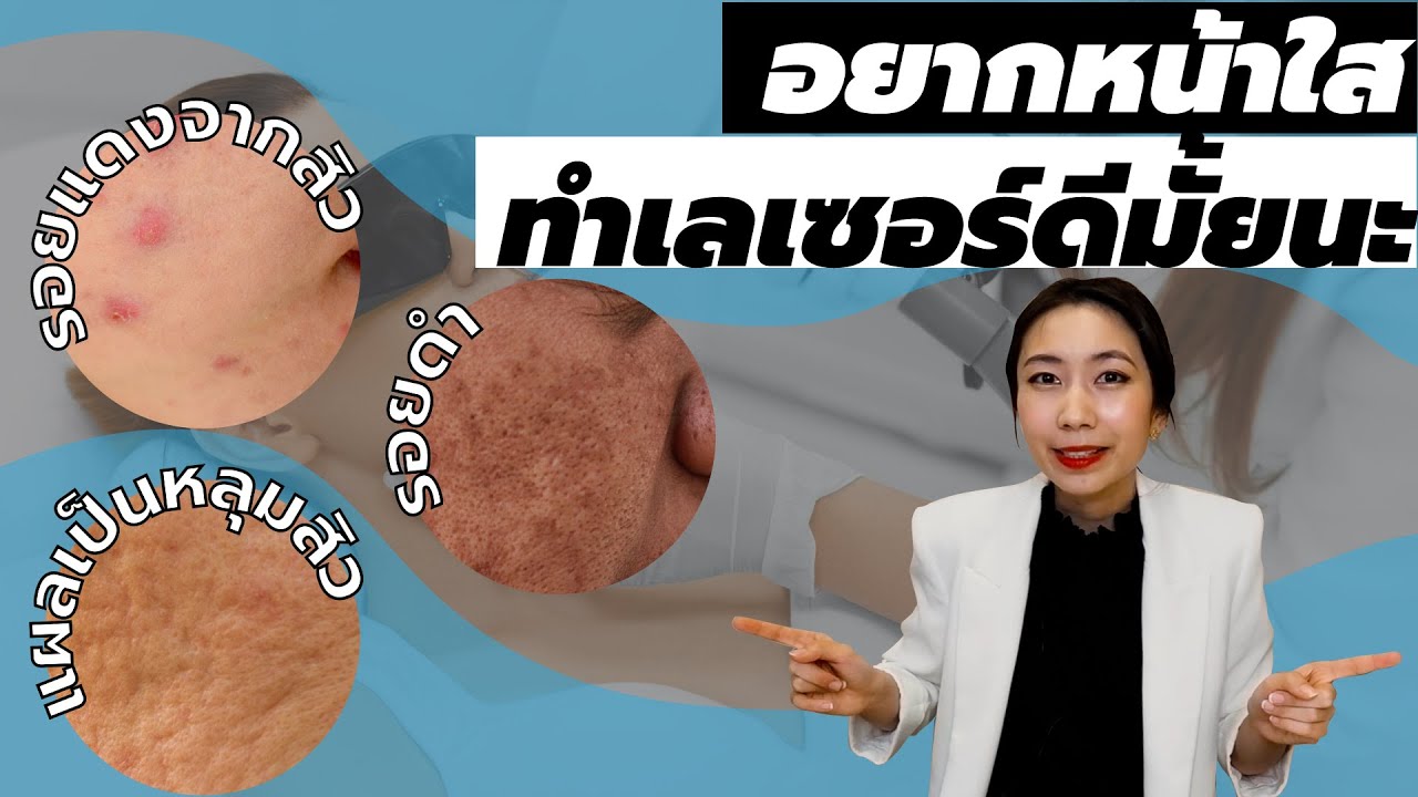 (กูรูชวนเช็ค) เลเซอร์หน้าใส เลือกยังไง ทำดีมั้ย?