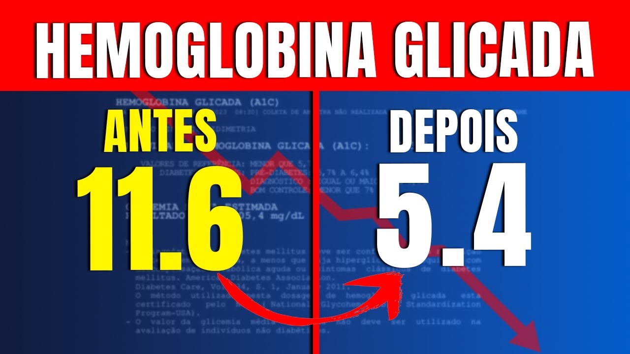 Como baixar a hemoglobina glicada de uma vez por todas